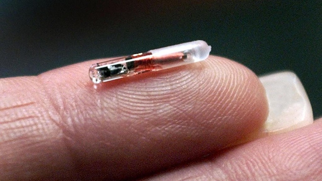 чип на пальце